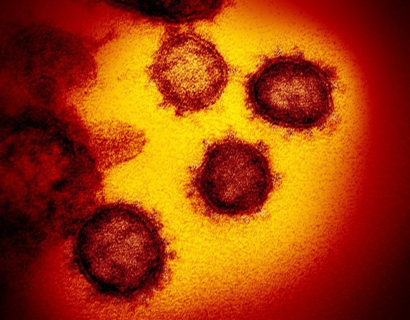 An image from an electron microscope shows SARS CoV 2 the virus that causes COVID 19. Scientists say this coronavirus has mutated and become more contagious