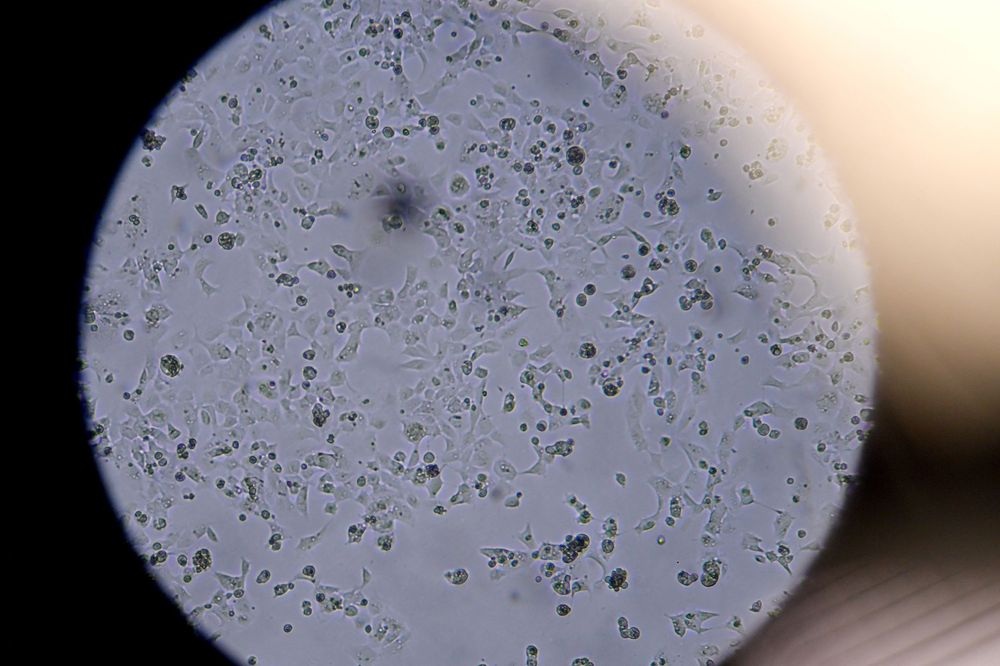 Cells containing coronavirus seen through a microscope